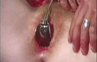 XXX پرستار فیلم سگسی جدید سرطان